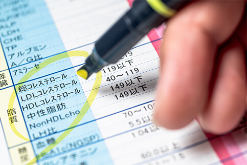 脂質異常症(高脂血症)
